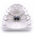 Jaw expansion devices