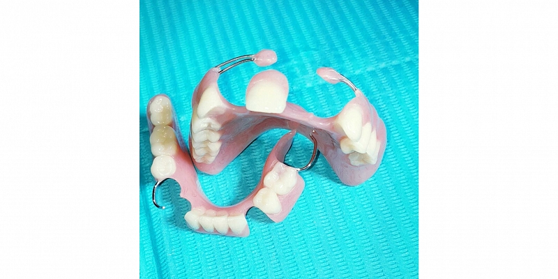 INSLA dental prosthetics