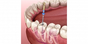 Dentistry prices