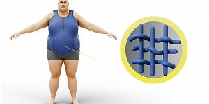 Ортезы