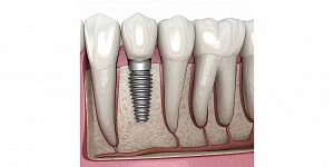Dentists