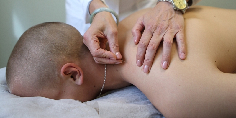 Иголочная терапия