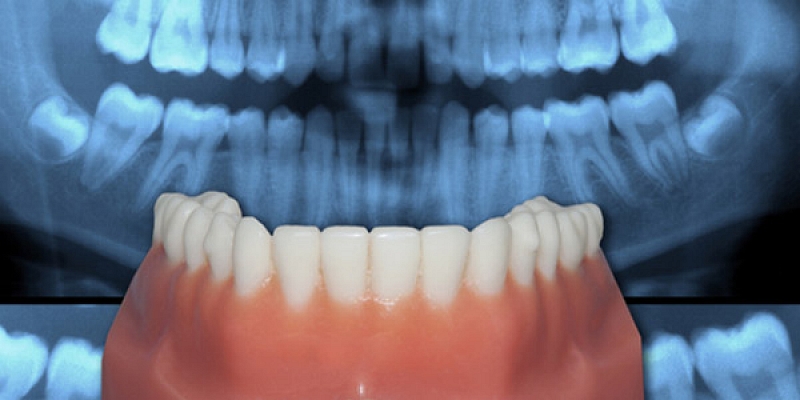 Orthodontics( bite correction)