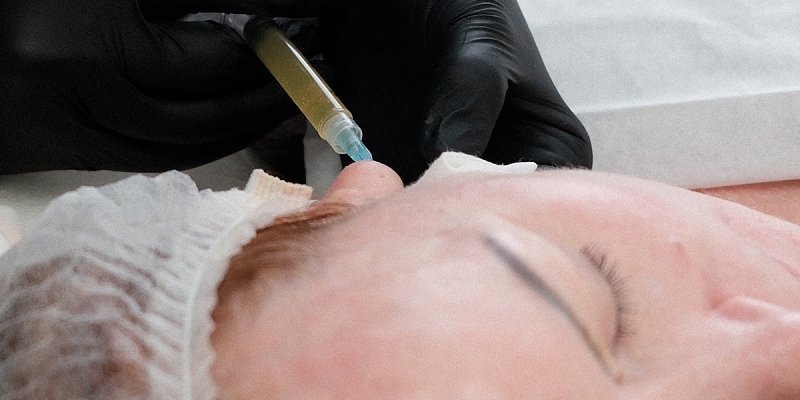 Инъекционная косметология