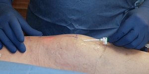 Лазерные операции