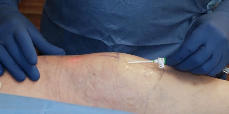 Лазерные операции