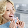 Teeth straightening with braces