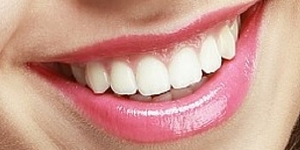 Dental hygienist